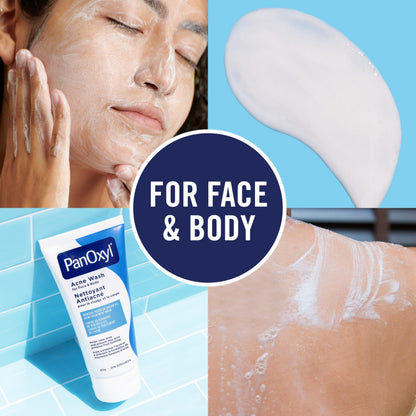 PanOxyl Acne Wash, 4% Benzoyl Peroxide, For Face & Body, 85g, Pack of 2