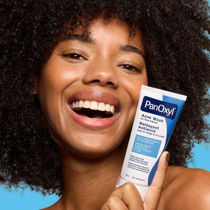 PanOxyl Acne Wash, 4% Benzoyl Peroxide, For Face & Body, 85g, Pack of 2